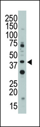 The anti-Siglec3 N-term antibody is used in Western blot to detect Siglec3 in Jurkat cell lysate.