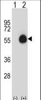 Western blot of CD33 (arrow) using rabbit polyclonal CD33 Antibody. 293 cell lysates (2 ug/lane) either nontransfected (Lane 1) or transiently transfected (Lane 2) with the CD33 gene.