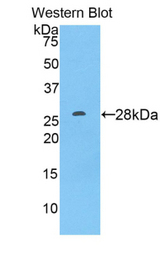 Western blot of recombinant ADAM9.