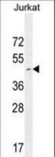 CD34 Antibody western blot of Jurkat cell line lysates (35 ug/lane). The CD34 antibody detected the CD34 protein (arrow).