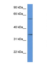 CD34 antibody LS-C135908 Western blot of HeLa Cell lysate. Antibody concentration 1 ug/ml.