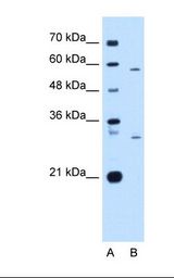 Lane A: Marker. Lane B: HepG2 cell lysate. Antibody concentration: 1.0 ug/ml. Gel concentration: 12%.