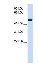 CD36 antibody LS-C111164 Western blot of Fetal Liver lysate.