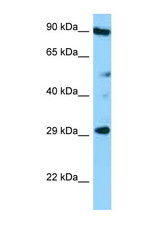 CD37 antibody LS-C146378 Western blot of HT1080 Cell lysate. Antibody concentration 1 ug/ml.