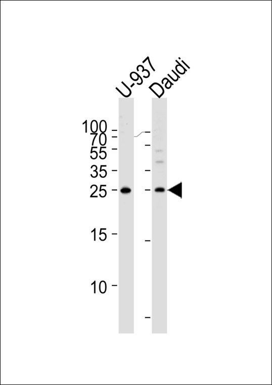 Western blot of lysates from U-937, Daudi cell line (from left to right), using CD37 Antibody. Antibody was diluted at 1:1000 at each lane. A goat anti-rabbit IgG H&L (HRP) at 1:5000 dilution was used as the secondary antibody. Lysates at 35ug per lane.