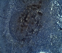 Staining on paraffin embedded normal human tonsil sections. Primary Ab (IgG cut or immunoaffinity purified) at 10 ug/ml. Antigen retrieval used: 10 mM Na Citrate pH 6.0, 10 minutes pressure cooker method., developed with anti rabbit HRP and DAP substrate. Counterstained with methyl blue.