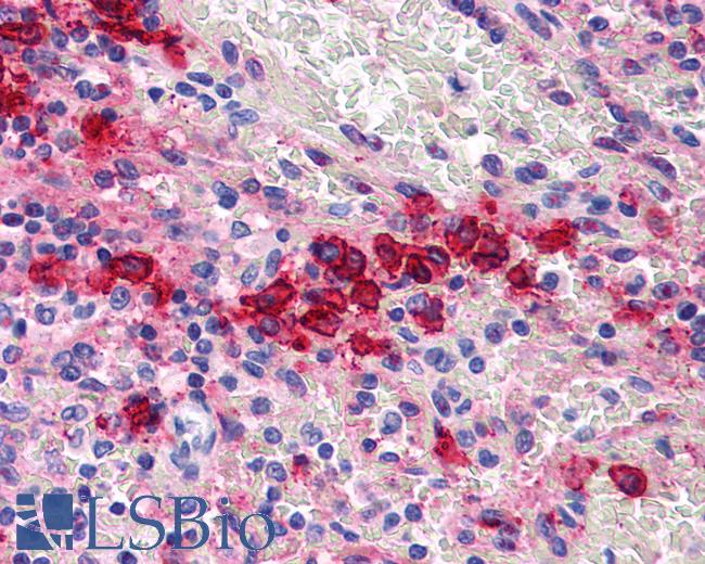 Anti-CD38 antibody LS-A9696 IHC of human spleen. Immunohistochemistry of formalin-fixed, paraffin-embedded tissue after heat-induced antigen retrieval.