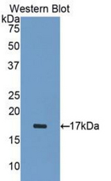 Western blot of recombinant ADAMTS1.