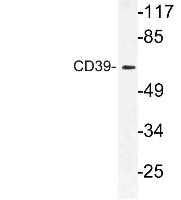 Western blot of CD39 (K388) pAb in extracts from Jurkat cells.