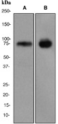 Western blot analysis on (A) human placenta and (B) IM-9 cell lysates using anti-CD39 antibody.