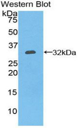Western blot of recombinant CD39.