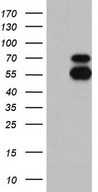 HEK293T cells were transfected with the pCMV6-ENTRY control (Left lane) or pCMV6-ENTRY ENTPD1 (Right lane) cDNA for 48 hrs and lysed. Equivalent amounts of cell lysates (5 ug per lane) were separated by SDS-PAGE and immunoblotted with anti-ENTPD1.