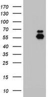 HEK293T cells were transfected with the pCMV6-ENTRY control (Left lane) or pCMV6-ENTRY ENTPD1 (Right lane) cDNA for 48 hrs and lysed. Equivalent amounts of cell lysates (5 ug per lane) were separated by SDS-PAGE and immunoblotted with anti-ENTPD1.