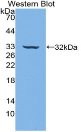 Western blot of recombinant CD39.