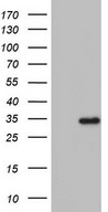 Human recombinant protein fragment corresponding to amino acids 38-307 of human ENTPD1 (NP_001767) produced in E.coli.