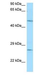 CD39 antibody Western Blot of Mouse Heart.