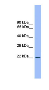 CD3E antibody LS-C116928 Western blot of Fetal Brain lysate.