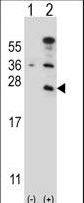 Western blot of CD3E (arrow) using rabbit polyclonal CD3E Antibody. 293 cell lysates (2 ug/lane) either nontransfected (Lane 1) or transiently transfected (Lane 2) with the CD3E gene.
