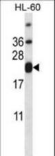 CD3E Antibody western blot of HL-60 cell line lysates (35 ug/lane). The CD3E antibody detected the CD3E protein (arrow).