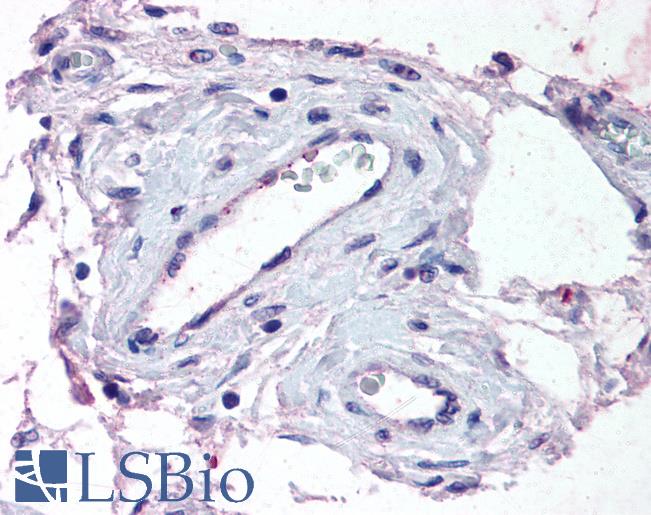 Anti-ADAMTS1 antibody LS-A1639 IHC of human testis, vessels. Immunohistochemistry of formalin-fixed, paraffin-embedded tissue after heat-induced antigen retrieval.