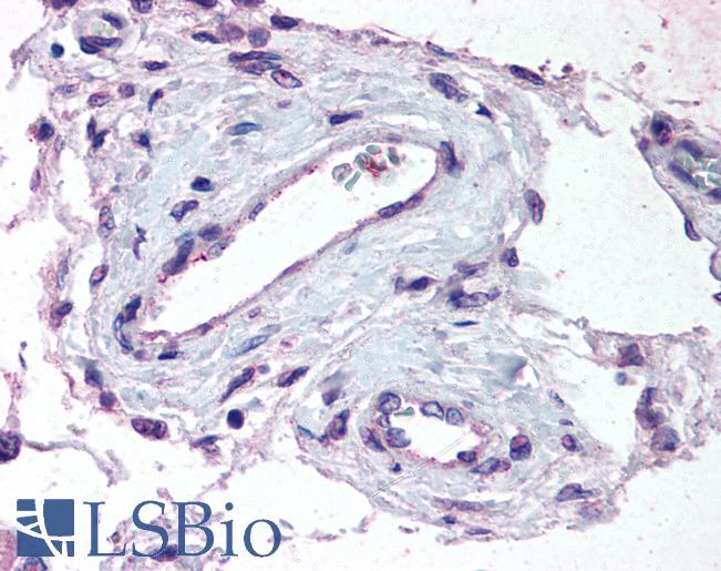 Anti-ADAMTS1 antibody LS-A1642 IHC of human testis, vessels. Immunohistochemistry of formalin-fixed, paraffin-embedded tissue after heat-induced antigen retrieval.