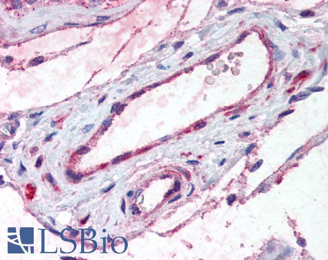 Anti-ADAMTS1 antibody LS-A1643 IHC of human testis, vessels. Immunohistochemistry of formalin-fixed, paraffin-embedded tissue after heat-induced antigen retrieval.