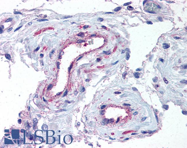 Anti-ADAMTS1 antibody LS-A1638 IHC of human testis, vessels. Immunohistochemistry of formalin-fixed, paraffin-embedded tissue after heat-induced antigen retrieval.