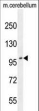 ADAMTS10 Antibody western blot of mouse cerebellum tissue lysates (35 ug/lane). The ADAMTS10 antibody detected the ADAMTS10 protein (arrow).