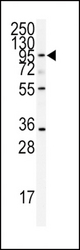 Western blot of anti-ADAMTS13 Antibody in CEM cell line lysates (35 ug/lane). ADAMTS13 (arrow) was detected using the purified antibody.
