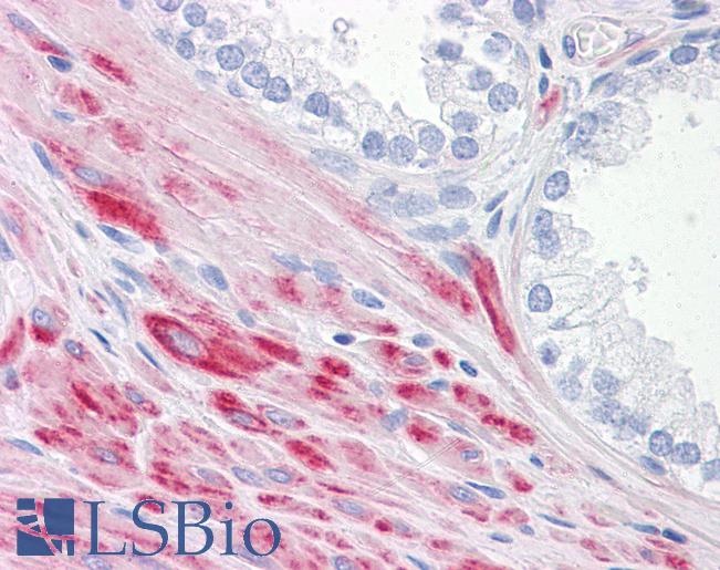 Anti-ADAMTS17 antibody IHC of human prostate. Immunohistochemistry of formalin-fixed, paraffin-embedded tissue after heat-induced antigen retrieval. Antibody LS-B4548 concentration 5 ug/ml.