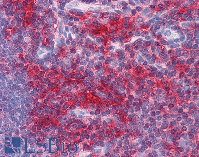 Anti-ADAMTS17 antibody IHC of human thymus. Immunohistochemistry of formalin-fixed, paraffin-embedded tissue after heat-induced antigen retrieval. Antibody LS-B4548 concentration 5 ug/ml.