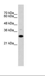 Raji Cell Lysate