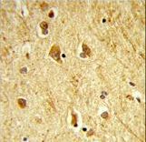 Formalin-fixed and paraffin-embedded human brain tissue reacted with ADAMTS18 Antibody , which was peroxidase-conjugated to the secondary antibody, followed by DAB staining. This data demonstrates the use of this antibody for immunohistochemistry; clinical relevance has not been evaluated.