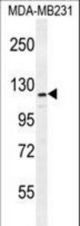 ADAMTS18 Antibody western blot of MDA-MB231 cell line lysates (35 ug/lane). The ADAMTS18 antibody detected the ADAMTS18 protein (arrow).