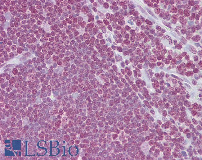 Anti-CD40LG / CD54 antibody IHC of human thymus. Immunohistochemistry of formalin-fixed, paraffin-embedded tissue after heat-induced antigen retrieval. Antibody LS-B6534 concentration 5 ug/ml.