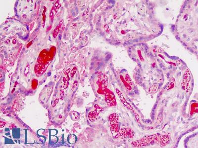 Human Placenta: Formalin-Fixed, Paraffin-Embedded (FFPE)