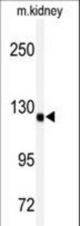 Western blot of anti-ADAMTS19 Antibody in mouse kidney tissue lysates (35 ug/lane). ADAMTS19 (arrow) was detected using the purified antibody.