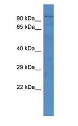ADAMTS4 antibody Western Blot of Rat Kidney.