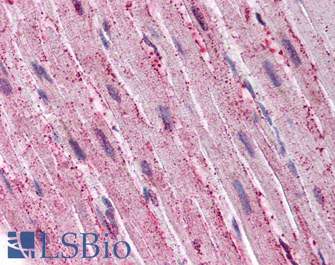 Anti-ADAMTS4 antibody LS-A1551 IHC of human heart. Immunohistochemistry of formalin-fixed, paraffin-embedded tissue after heat-induced antigen retrieval.