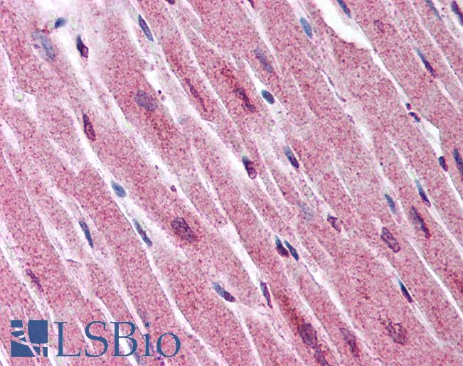 Anti-ADAMTS4 antibody LS-A1549 IHC of human heart. Immunohistochemistry of formalin-fixed, paraffin-embedded tissue after heat-induced antigen retrieval.