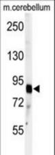 Western blot of anti-ADAMTS4 Antibody in mouse cerebellum tissue lysates (35 ug/lane). ADAMTS4 (arrow) was detected using the purified antibody.