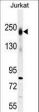 PTPRC Antibody western blot of Jurkat cell line lysates (35 ug/lane). The PTPRC antibody detected the PTPRC protein (arrow).