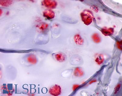 Anti-ADAMTS4 antibody LS-A7770 IHC of human cartilage. Immunohistochemistry of formalin-fixed, paraffin-embedded tissue after heat-induced antigen retrieval.