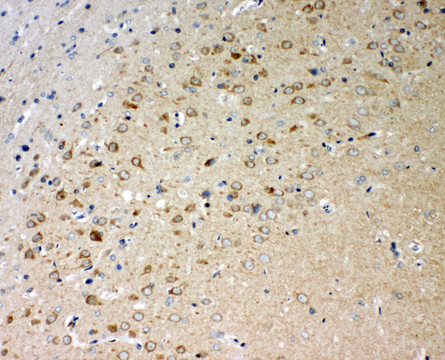 ADAMTS5 antibody. IHC(P): Rat Brain Tissue.