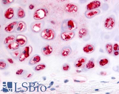 Anti-ADAMTS5 antibody LS-A7768 IHC of human cartilage. Immunohistochemistry of formalin-fixed, paraffin-embedded tissue after heat-induced antigen retrieval.