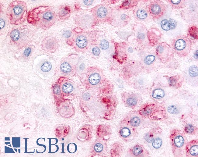 Anti-ADAMTS5 antibody IHC of human placenta. Immunohistochemistry of formalin-fixed, paraffin-embedded tissue after heat-induced antigen retrieval.