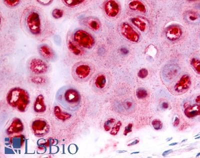 Anti-ADAMTS5 antibody LS-A7761 IHC of human cartilage. Immunohistochemistry of formalin-fixed, paraffin-embedded tissue after heat-induced antigen retrieval.