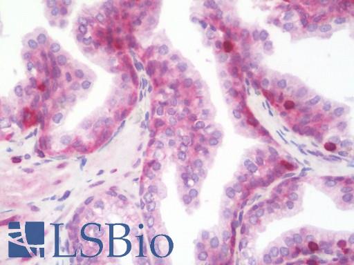 Anti-CD47 antibody IHC staining of human prostate. Immunohistochemistry of formalin-fixed, paraffin-embedded tissue after heat-induced antigen retrieval. Antibody LS-B10546 dilution 1:100.