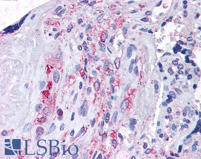 Anti-ADAMTS5 antibody LS-A1534 IHC of human placenta. Immunohistochemistry of formalin-fixed, paraffin-embedded tissue after heat-induced antigen retrieval.