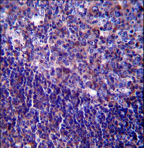 CD5 Antibody immunohistochemistry of formalin-fixed and paraffin-embedded human tonsil tissue followed by peroxidase-conjugated secondary antibody and DAB staining.